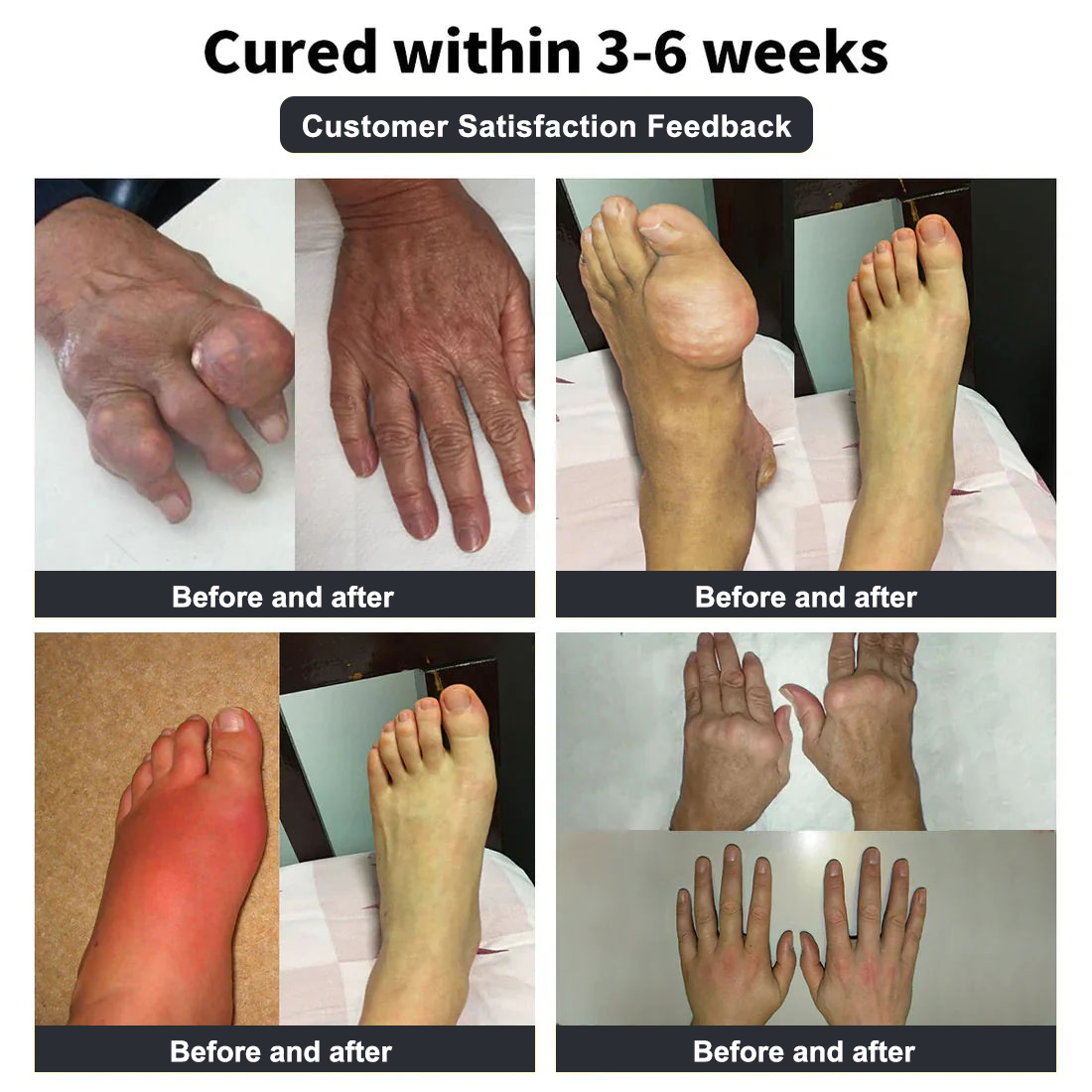 Vioralifesโข Bee Venom and Turmeric Joint and Bone Pain Relief Cream ๐จโโ๏ธ Approved by the American Academy of Orthopaedic Surgeons (AAOS)
