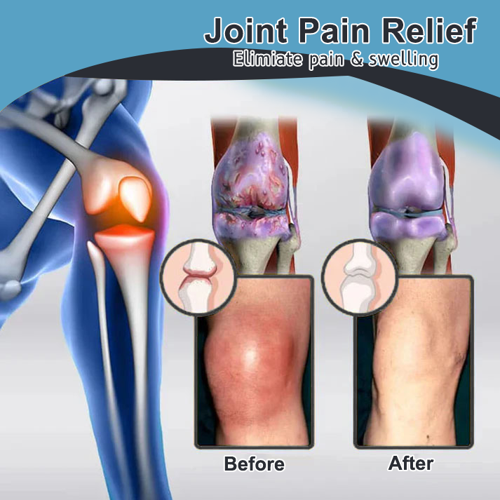 Vioralifesโข Bee Venom and Turmeric Joint and Bone Pain Relief Cream ๐จโโ๏ธ Approved by the American Academy of Orthopaedic Surgeons (AAOS)