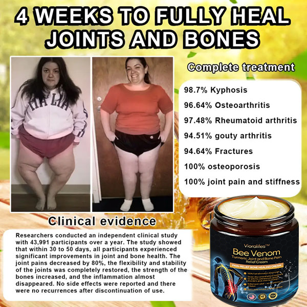 Vioralifesโข Bee Venom and Turmeric Joint and Bone Pain Relief Cream ๐จโโ๏ธ Approved by the American Academy of Orthopaedic Surgeons (AAOS)