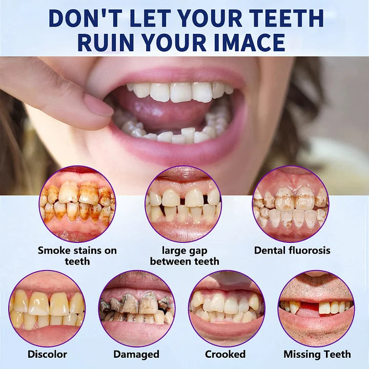 VioralifesĀ®-š¦·Advanced Customized Full Denture Set𦷠(ā°Limited time discount last 30 minutesā°)