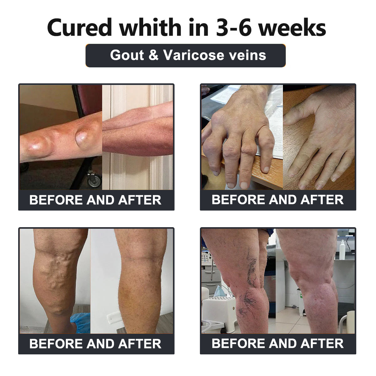 Vioralifesโข Bee Venom and Turmeric Joint and Bone Pain Relief Cream ๐จโโ๏ธ Approved by the American Academy of Orthopaedic Surgeons (AAOS)
