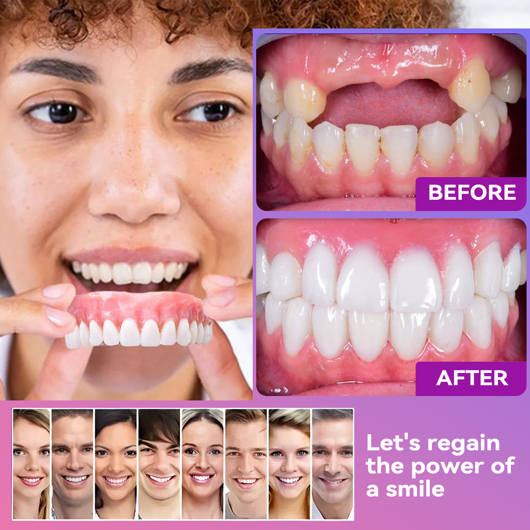 Vioralifes® Next-Generation Comfort Dentures 🦷(Luxurious dentures, lightweight and easy to wear — limited-time 70% OFF)
