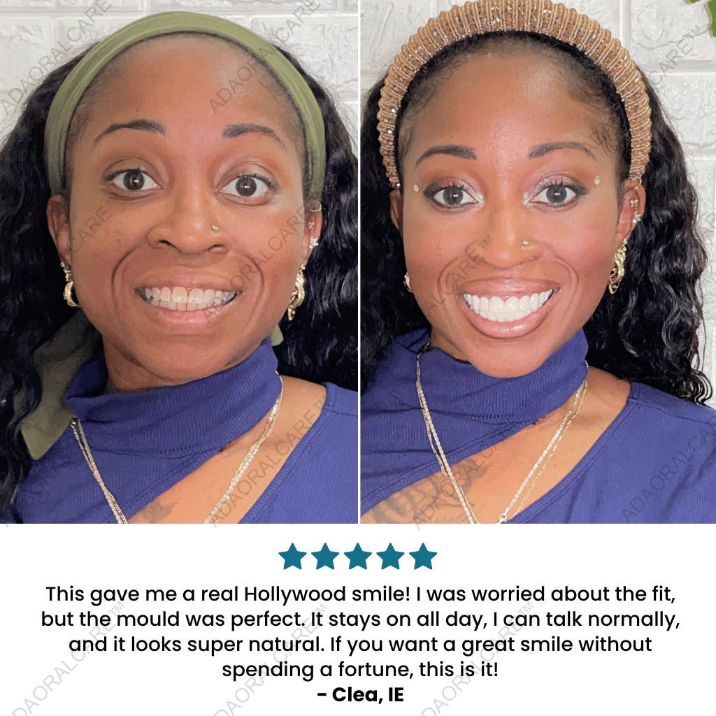 ADAORALCARE™Clip-On Veneers — Instant, Custom Fit Smile in Seconds