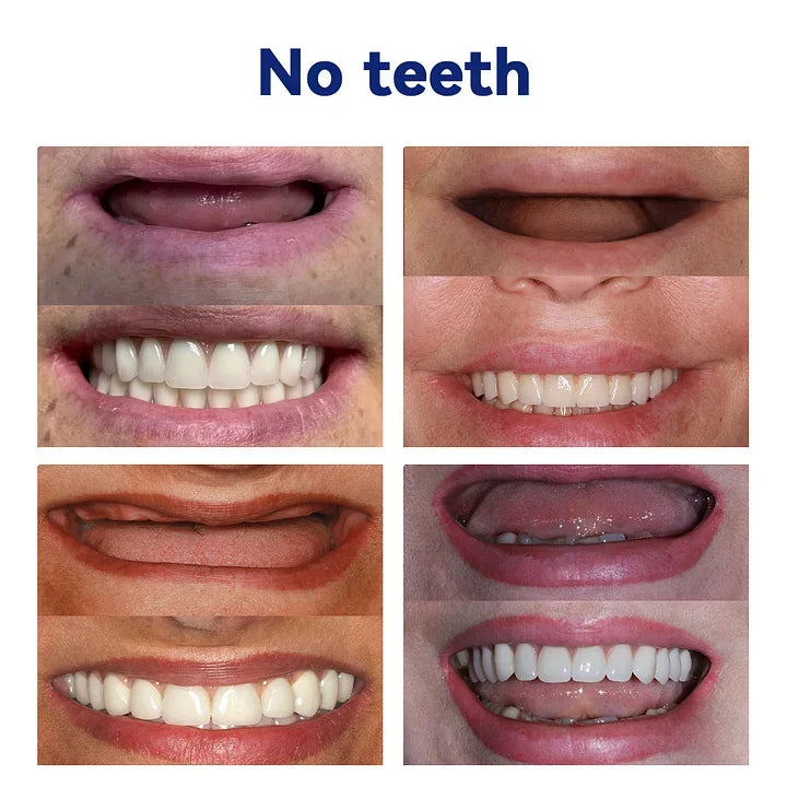 VioralifesĀ®-š¦·Advanced Customized Full Denture Set𦷠(ā°Limited time discount last 30 minutesā°)