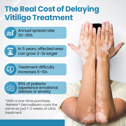 Natravor® DermaBeam Vitiligo Therapy Device ✅3-5 Second Vitiligo Treatment, Visible Results in Just 2 Weeks