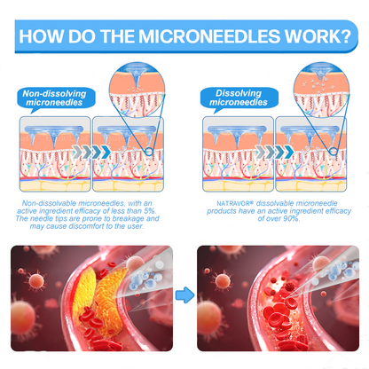 FDA Store·𝐍𝐚𝐭𝐫𝐚𝐯𝐨𝐫®𝐒𝐥𝐢𝐦 & 𝐅𝐢𝐫𝐦 𝐍𝐚𝐧𝐨 𝐌𝐢𝐜𝐫𝐨𝐧𝐞𝐞𝐝𝐥𝐞 𝐏𝐚𝐭𝐜𝐡 𝐰𝐢𝐭𝐡 𝐌𝐨𝐫𝐢𝐧𝐠𝐚, 𝐎𝐦𝐞𝐠𝐚-𝟑, 𝐂𝐨𝐥𝐥𝐚𝐠𝐞𝐧 𝐏𝐞𝐩𝐭𝐢𝐝𝐞𝐬, 𝐍𝐀𝐃 & 𝐍𝐌𝐍 𝐟𝐨𝐫 𝐎𝐛𝐞𝐬𝐢𝐭𝐲, 𝐂𝐚𝐫𝐝𝐢𝐨𝐯𝐚𝐬𝐜𝐮𝐥𝐚𝐫 𝐃𝐢𝐬𝐞𝐚𝐬𝐞, 𝐃𝐢𝐚𝐛𝐞𝐭𝐞𝐬, 𝐒𝐥𝐞𝐞𝐩 𝐀𝐩𝐧𝐞𝐚, 𝐉𝐨𝐢𝐧𝐭 𝐏𝐫𝐨𝐛𝐥𝐞𝐦𝐬, 𝐒𝐤𝐢𝐧 𝐅𝐢𝐫𝐦𝐢𝐧𝐠, 𝐀𝐧𝐭𝐢-𝐀𝐠𝐢𝐧𝐠, 𝐚𝐧𝐝 𝐌𝐨𝐫𝐞