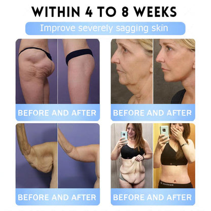 FDA Store·𝐍𝐚𝐭𝐫𝐚𝐯𝐨𝐫®𝐒𝐥𝐢𝐦 & 𝐅𝐢𝐫𝐦 𝐍𝐚𝐧𝐨 𝐌𝐢𝐜𝐫𝐨𝐧𝐞𝐞𝐝𝐥𝐞 𝐏𝐚𝐭𝐜𝐡 𝐰𝐢𝐭𝐡 𝐌𝐨𝐫𝐢𝐧𝐠𝐚, 𝐎𝐦𝐞𝐠𝐚-𝟑, 𝐂𝐨𝐥𝐥𝐚𝐠𝐞𝐧 𝐏𝐞𝐩𝐭𝐢𝐝𝐞𝐬, 𝐍𝐀𝐃 & 𝐍𝐌𝐍 𝐟𝐨𝐫 𝐎𝐛𝐞𝐬𝐢𝐭𝐲, 𝐂𝐚𝐫𝐝𝐢𝐨𝐯𝐚𝐬𝐜𝐮𝐥𝐚𝐫 𝐃𝐢𝐬𝐞𝐚𝐬𝐞, 𝐃𝐢𝐚𝐛𝐞𝐭𝐞𝐬, 𝐒𝐥𝐞𝐞𝐩 𝐀𝐩𝐧𝐞𝐚, 𝐉𝐨𝐢𝐧𝐭 𝐏𝐫𝐨𝐛𝐥𝐞𝐦𝐬, 𝐒𝐤𝐢𝐧 𝐅𝐢𝐫𝐦𝐢𝐧𝐠, 𝐀𝐧𝐭𝐢-𝐀𝐠𝐢𝐧𝐠, 𝐚𝐧𝐝 𝐌𝐨𝐫𝐞