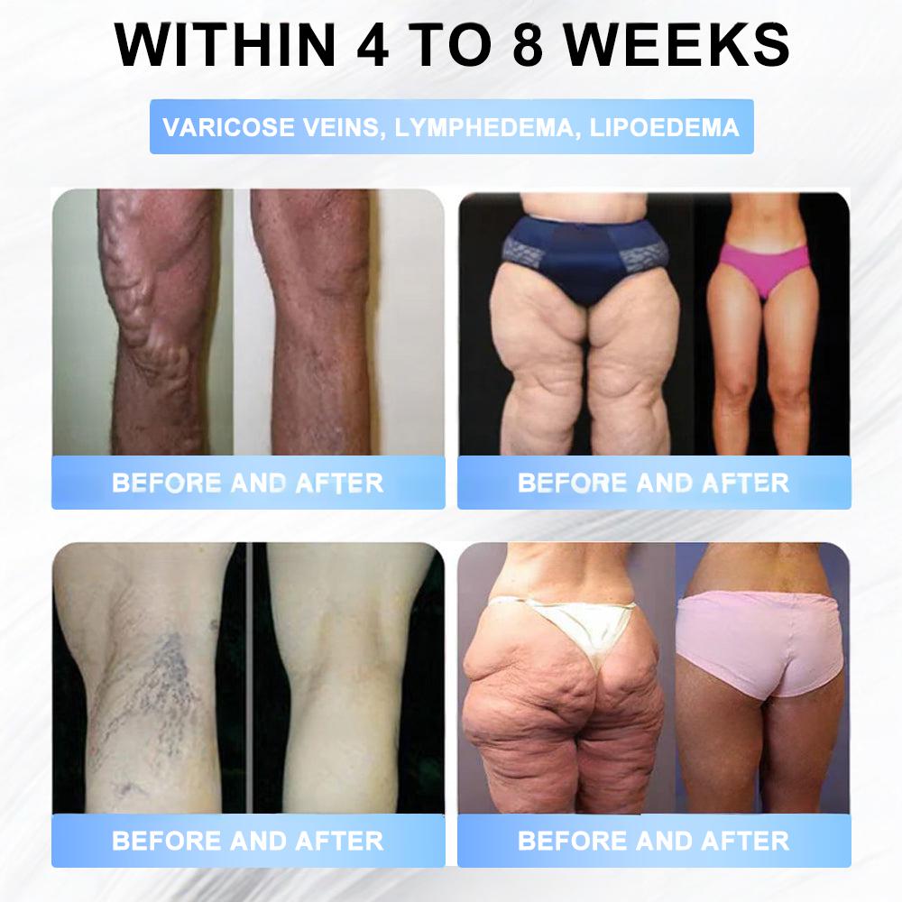 FDA Store·𝐍𝐚𝐭𝐫𝐚𝐯𝐨𝐫®𝐒𝐥𝐢𝐦 & 𝐅𝐢𝐫𝐦 𝐍𝐚𝐧𝐨 𝐌𝐢𝐜𝐫𝐨𝐧𝐞𝐞𝐝𝐥𝐞 𝐏𝐚𝐭𝐜𝐡 𝐰𝐢𝐭𝐡 𝐌𝐨𝐫𝐢𝐧𝐠𝐚, 𝐎𝐦𝐞𝐠𝐚-𝟑, 𝐂𝐨𝐥𝐥𝐚𝐠𝐞𝐧 𝐏𝐞𝐩𝐭𝐢𝐝𝐞𝐬, 𝐍𝐀𝐃 & 𝐍𝐌𝐍 𝐟𝐨𝐫 𝐎𝐛𝐞𝐬𝐢𝐭𝐲, 𝐂𝐚𝐫𝐝𝐢𝐨𝐯𝐚𝐬𝐜𝐮𝐥𝐚𝐫 𝐃𝐢𝐬𝐞𝐚𝐬𝐞, 𝐃𝐢𝐚𝐛𝐞𝐭𝐞𝐬, 𝐒𝐥𝐞𝐞𝐩 𝐀𝐩𝐧𝐞𝐚, 𝐉𝐨𝐢𝐧𝐭 𝐏𝐫𝐨𝐛𝐥𝐞𝐦𝐬, 𝐒𝐤𝐢𝐧 𝐅𝐢𝐫𝐦𝐢𝐧𝐠, 𝐀𝐧𝐭𝐢-𝐀𝐠𝐢𝐧𝐠, 𝐚𝐧𝐝 𝐌𝐨𝐫𝐞