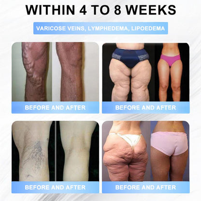 FDA Store·𝐍𝐚𝐭𝐫𝐚𝐯𝐨𝐫®𝐒𝐥𝐢𝐦 & 𝐅𝐢𝐫𝐦 𝐍𝐚𝐧𝐨 𝐌𝐢𝐜𝐫𝐨𝐧𝐞𝐞𝐝𝐥𝐞 𝐏𝐚𝐭𝐜𝐡 𝐰𝐢𝐭𝐡 𝐌𝐨𝐫𝐢𝐧𝐠𝐚, 𝐎𝐦𝐞𝐠𝐚-𝟑, 𝐂𝐨𝐥𝐥𝐚𝐠𝐞𝐧 𝐏𝐞𝐩𝐭𝐢𝐝𝐞𝐬, 𝐍𝐀𝐃 & 𝐍𝐌𝐍 𝐟𝐨𝐫 𝐎𝐛𝐞𝐬𝐢𝐭𝐲, 𝐂𝐚𝐫𝐝𝐢𝐨𝐯𝐚𝐬𝐜𝐮𝐥𝐚𝐫 𝐃𝐢𝐬𝐞𝐚𝐬𝐞, 𝐃𝐢𝐚𝐛𝐞𝐭𝐞𝐬, 𝐒𝐥𝐞𝐞𝐩 𝐀𝐩𝐧𝐞𝐚, 𝐉𝐨𝐢𝐧𝐭 𝐏𝐫𝐨𝐛𝐥𝐞𝐦𝐬, 𝐒𝐤𝐢𝐧 𝐅𝐢𝐫𝐦𝐢𝐧𝐠, 𝐀𝐧𝐭𝐢-𝐀𝐠𝐢𝐧𝐠, 𝐚𝐧𝐝 𝐌𝐨𝐫𝐞