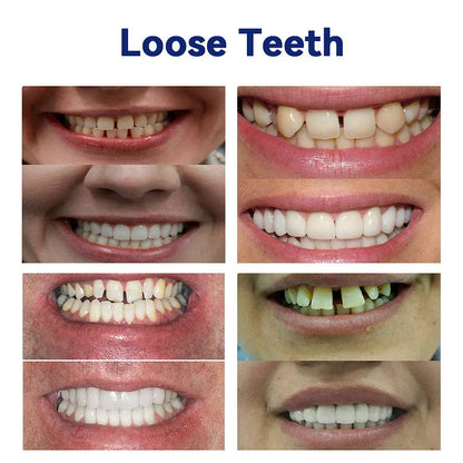 Vioralifes®-🦷Advanced Customized Full Denture Set🦷 (⏰Limited time discount last 30 minutes⏰)