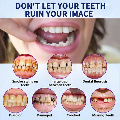 Vioralifes®-🦷Advanced Customized Full Denture Set🦷 (⏰Limited time discount last 30 minutes⏰)