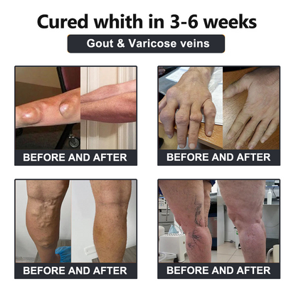 Vioralifes™ Bee Venom and Turmeric Joint and Bone Pain Relief Cream 👨‍⚕️ Approved by the American Academy of Orthopaedic Surgeons (AAOS)
