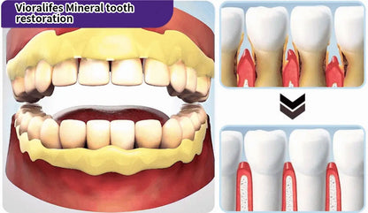Vioralifes™ Teeth Restoration Mineral Powder🦷(ADA Recommended) (🎁Flash Sale - Don’t Miss Out)