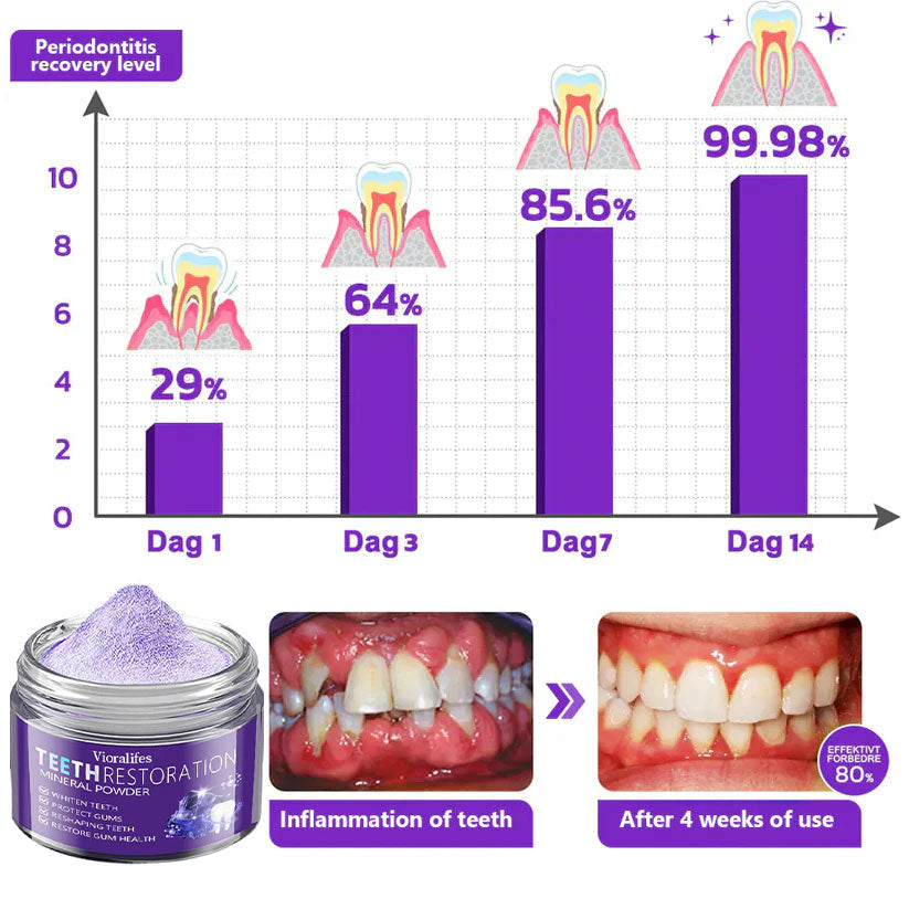 Vioralifes™ Teeth Restoration Mineral Powder🦷(ADA Recommended) (🎁Flash Sale - Don’t Miss Out)