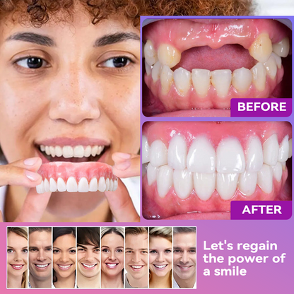 Vioralifes® Next-Generation Comfort Dentures 🦷(Luxurious dentures, lightweight and easy to wear — limited-time 70% OFF)