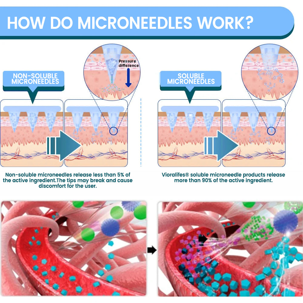 【Limited-Time Launch – Enjoy 70% OFF】 Vioralifes®🍃 NIDDK-Tirzepatide Nano Painless Microneedle Patch ✨ Zero-Pain Technology | 24/7 Metabolism Support | Lose 9kg Fast | 90%+ Sugar Reduction          Ask ChatGPT