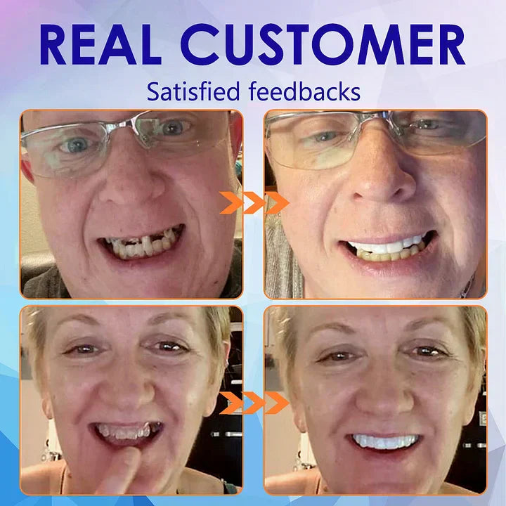 Vioralifes®-🦷Advanced Customized Full Denture Set🦷 (⏰Limited time discount last 30 minutes⏰)