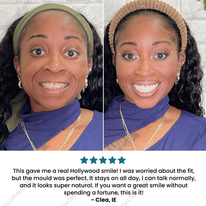 ADAORALCARE™Clip-On Veneers — Instant, Custom Fit Smile in Seconds