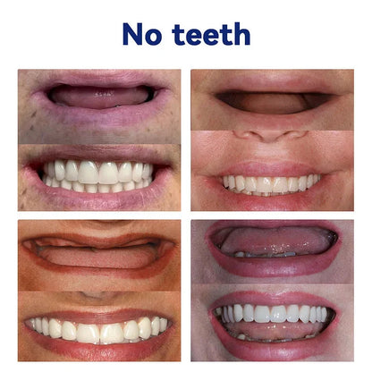 Vioralifes®-🦷Advanced Customized Full Denture Set🦷 (⏰Limited time discount last 30 minutes⏰)