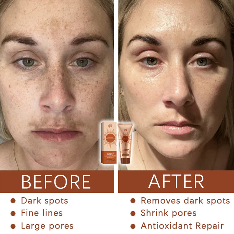 Herbal Spots Peel-Off Facial Mask | LIMITED DISCOUNT OFFER✨