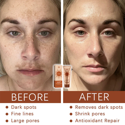 Herbal Spots Peel-Off Facial Mask | LIMITED DISCOUNT OFFER✨